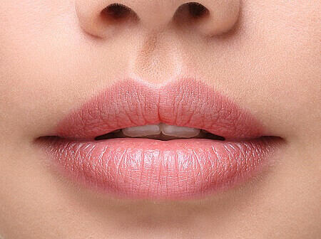 Lippen aufspritzen aktuelle Trends - KÖ-KLINIK